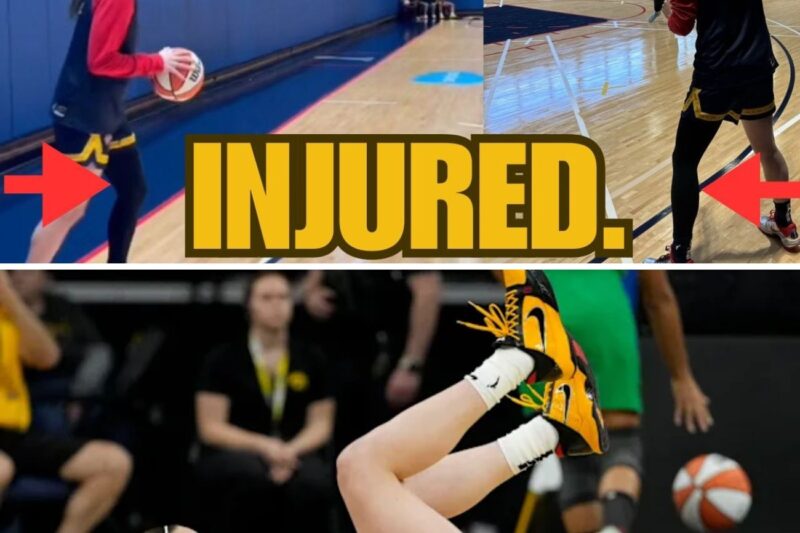 Fever on Edge: Caitlin Clark Spotted in Leg Compression Sleeve Amid Injury Fears