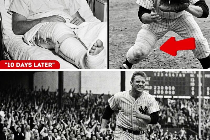 “Mickey Mantle’s Knee Exploded During World Series — What He Did 10 Days Later Shocked Everyone”