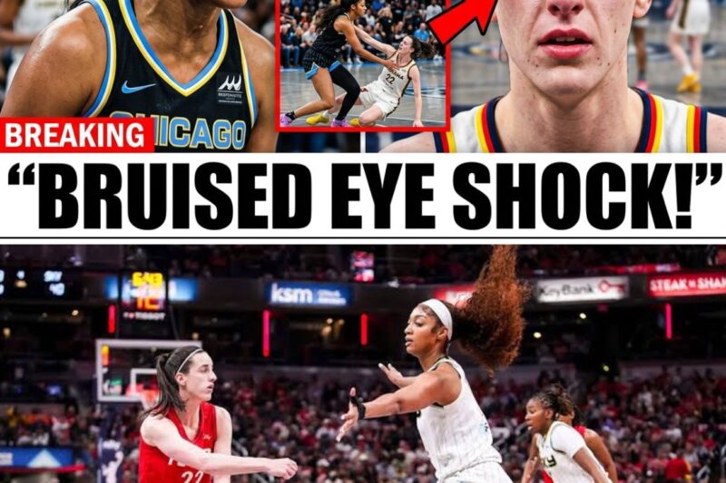 Caitlin Clark Left With Black Eye After Angel Reese Elbow as WNBA Officials Face Backlash